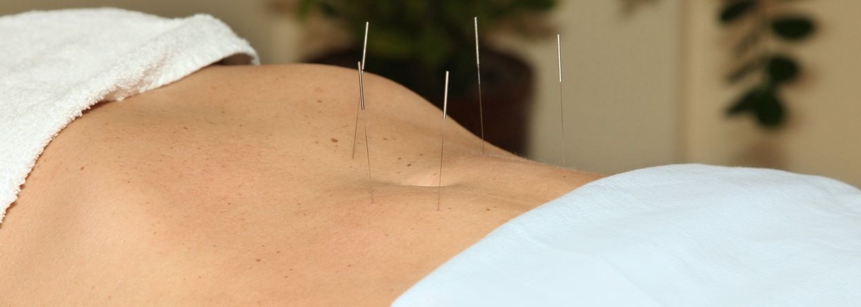 Accupuncture image