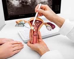 Gynecology image