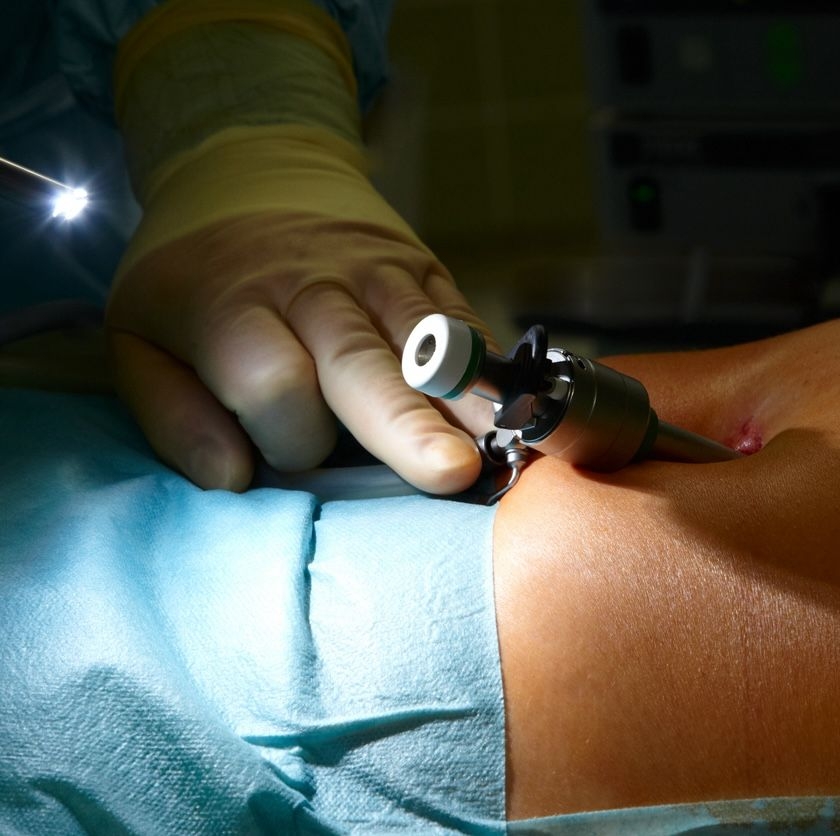 Laparoscopy image