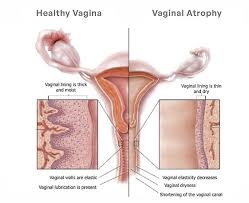 Augmentation and Rejuvenation with Hyaluronic Acid image